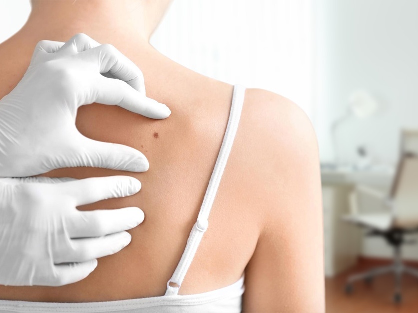 Kožní ambulance - MUDr. Lenka Kráľovičová