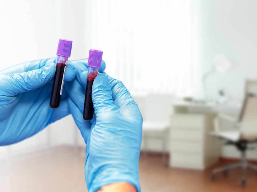 Biochemická a hematologická laboratoř SPADIA LAB - Poliklinika SPADIA Hodonín